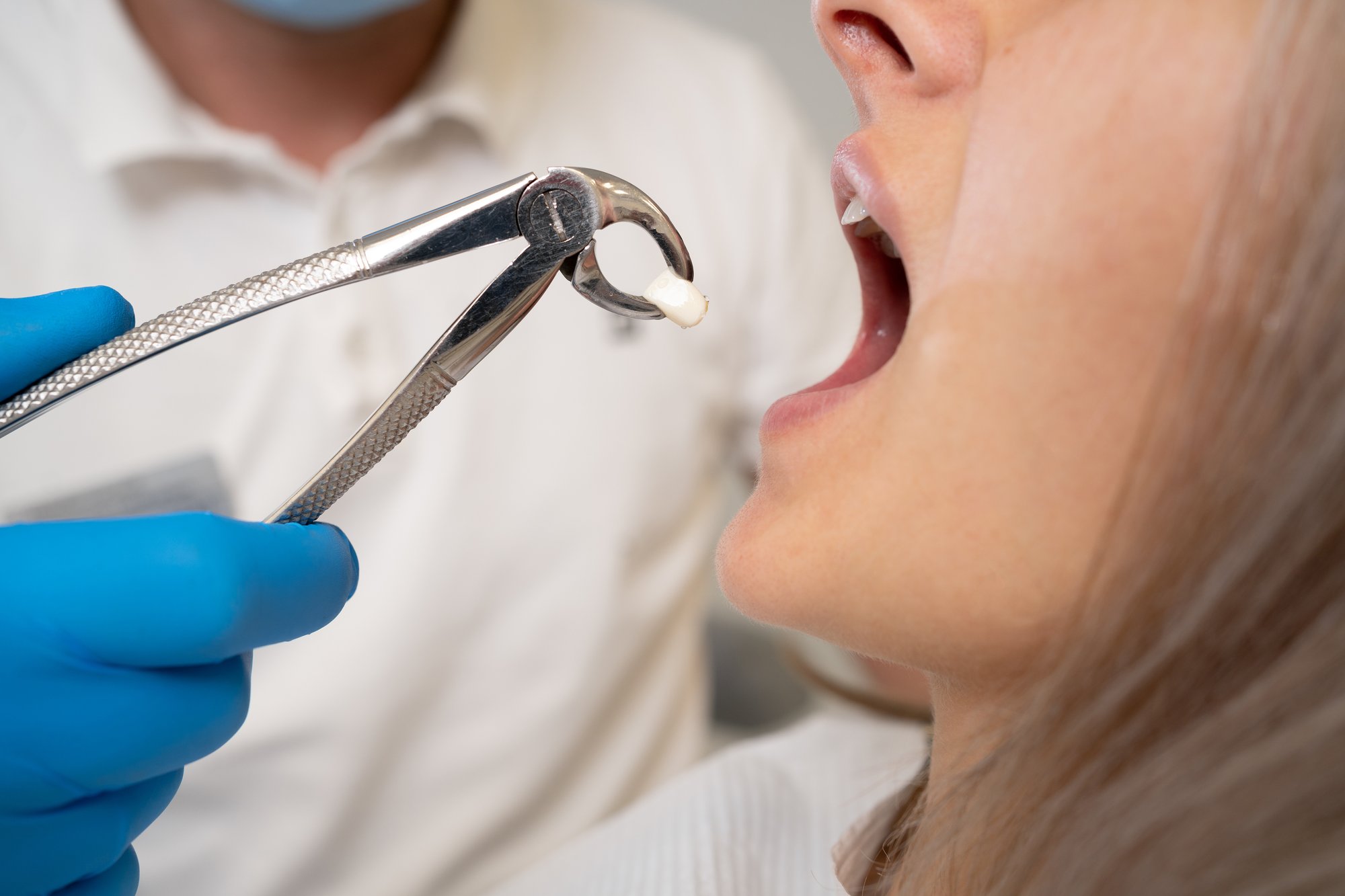 What Raises My Risk of Dry Socket?